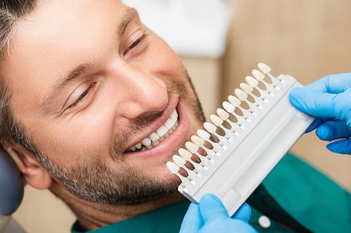 Dental Veneers in Chandler and why do you need them?