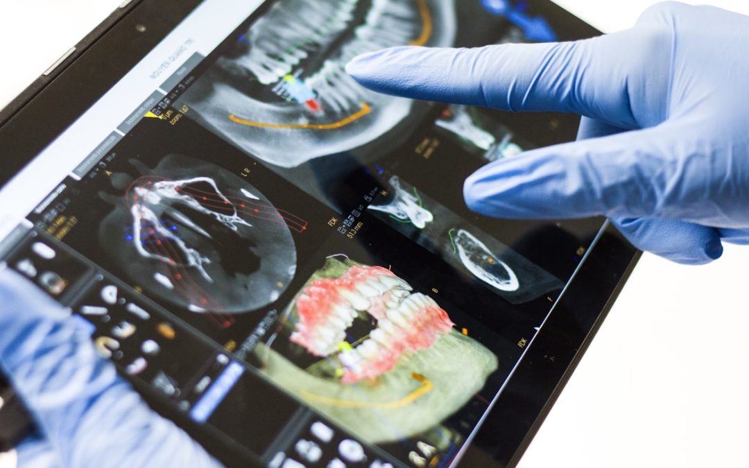 The Marvel of Digitally Guided Surgery for Implant Placement