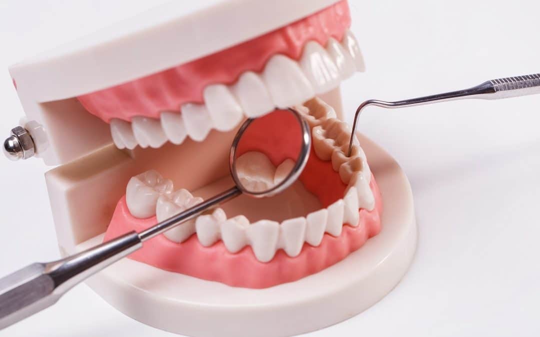What to Expect When Getting Your Wisdom Tooth Removed