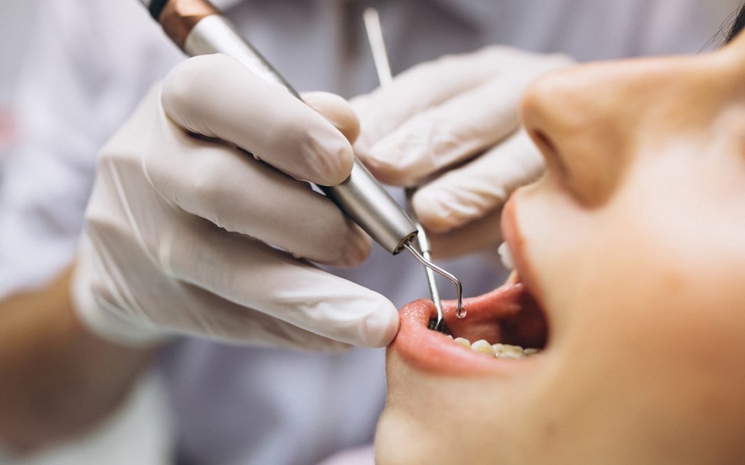 What is a Tooth Extraction, and when is it Necessary?
