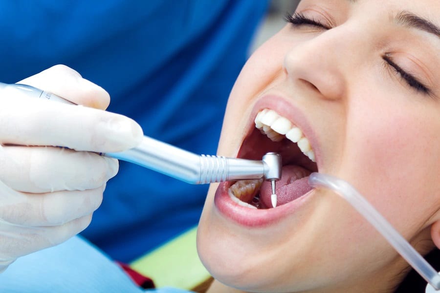 How Long Does It Take to Recover from a Root Canal Procedure?