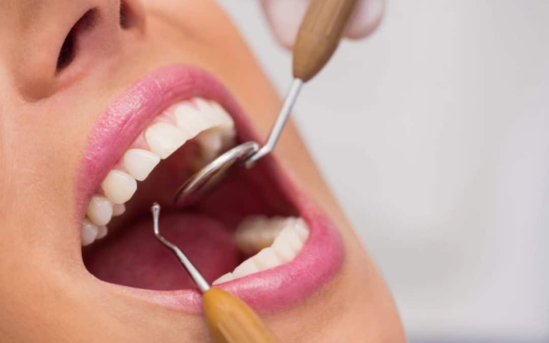 What to do before getting a Root Canal Surgery
