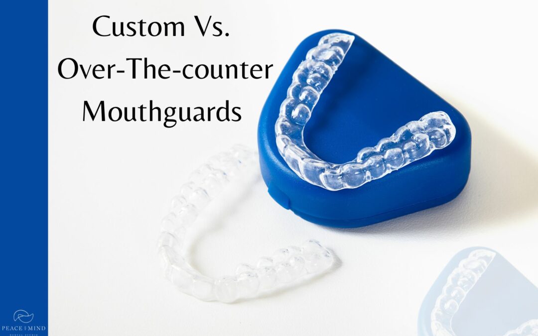 Custom Vs. Over-The-counter Mouthguards
