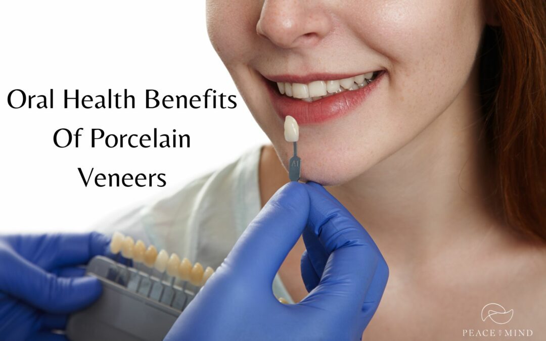 Oral Health Benefits Of Porcelain Veneers