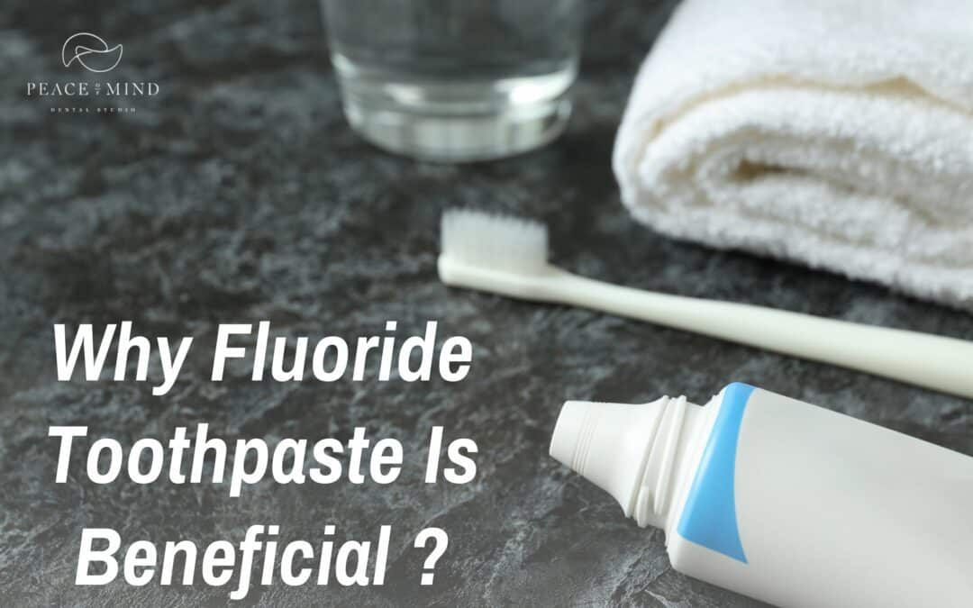 How Can Fluoride Toothpaste Benefit Your Teeth?
