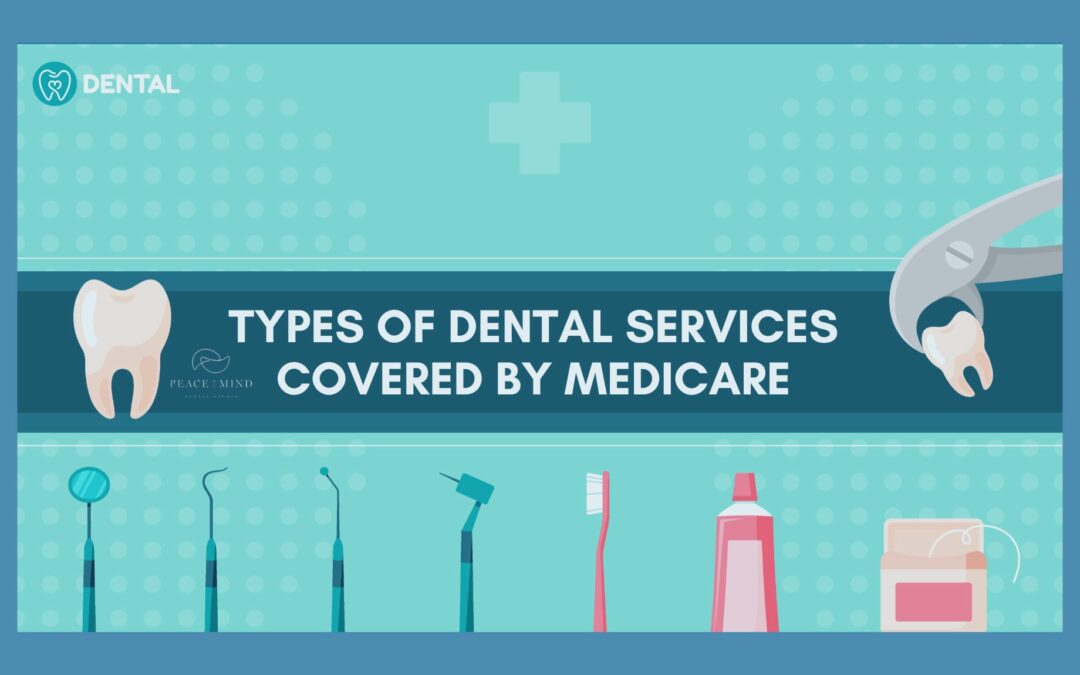Types of Dental Services Covered by Medicare