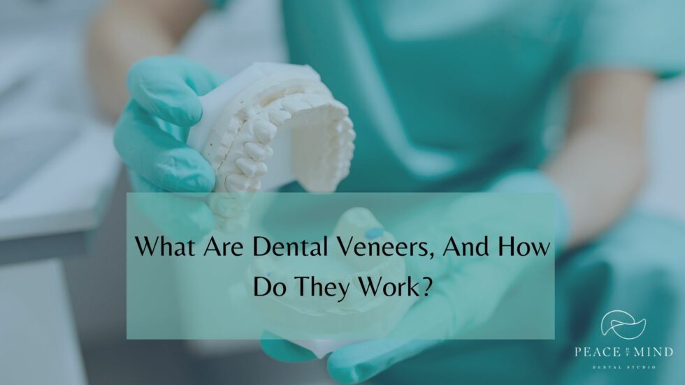 What Are Dental Veneers, And How Do They Work?