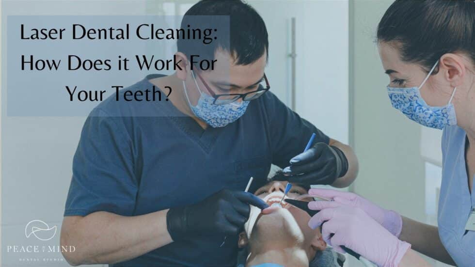 Laser Dental Cleaning How Does it Work For Your Teeth?