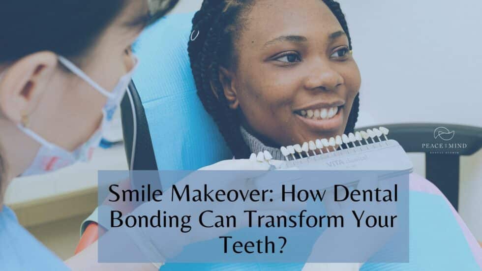 Smile Makeover How Dental Bonding Can Transform Your Teeth?
