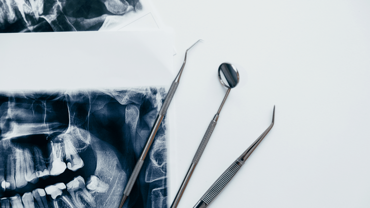 Effective Bone Sequestra Treatment POM Dental Studio