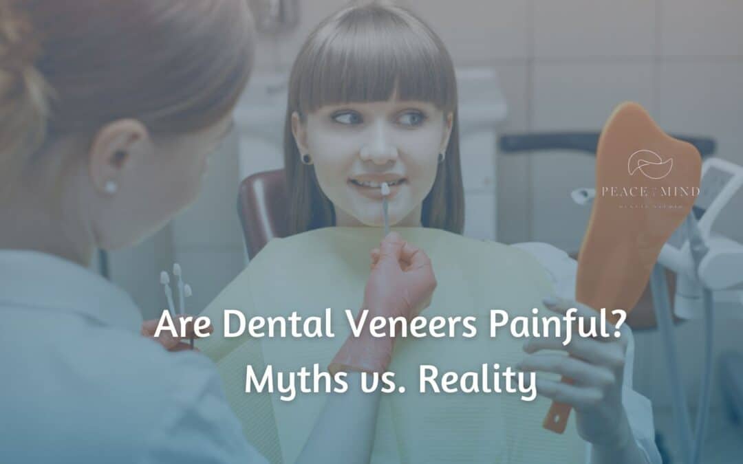 Are Dental Veneers Painful? Myths vs. Reality