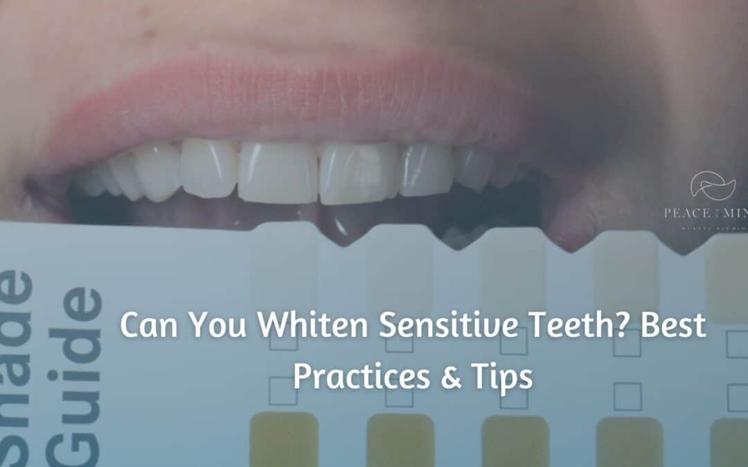 Can You Whiten Sensitive Teeth? Best Practices & Tips
