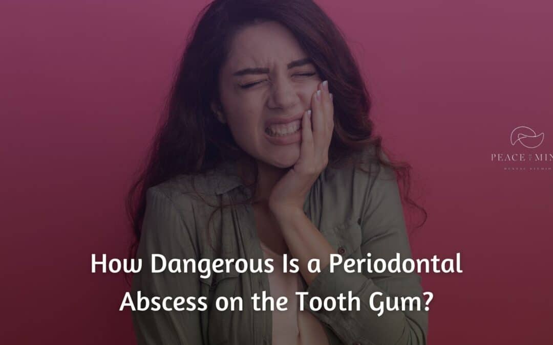 How Dangerous Is a Periodontal Abscess on the Tooth Gum?