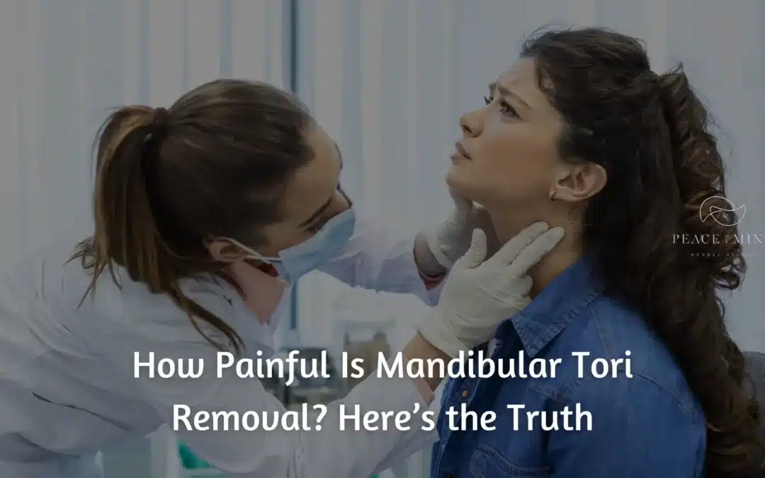 How Painful Is Mandibular Tori Removal? Here’s the Truth