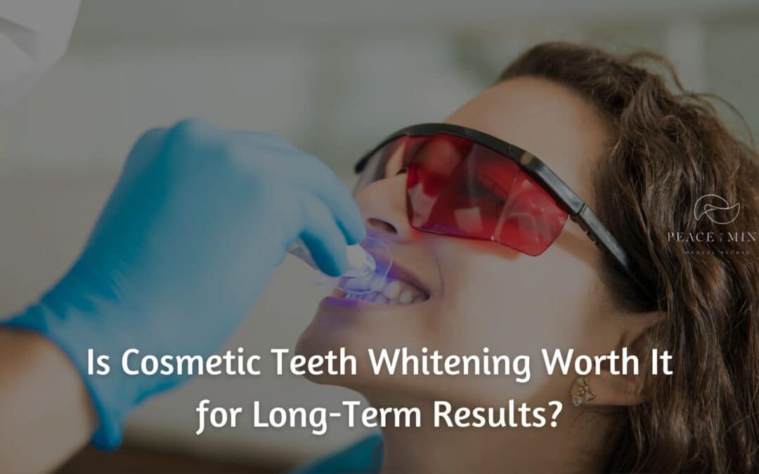Is Cosmetic Teeth Whitening Worth It for Long-Term Results?