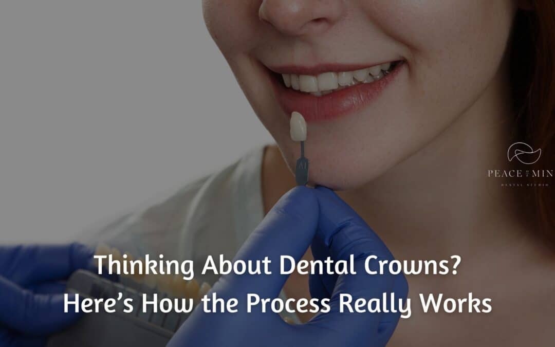 Thinking About Dental Crowns? Here’s How the Process Really Works