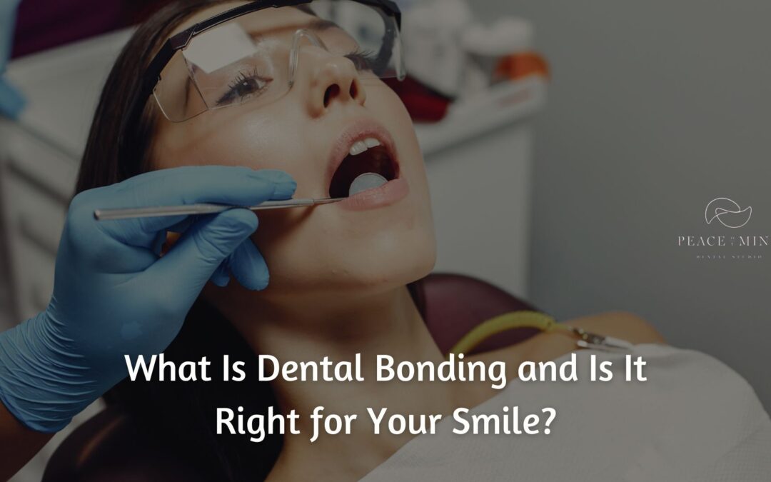 What Is Dental Bonding and Is It Right for Your Smile?