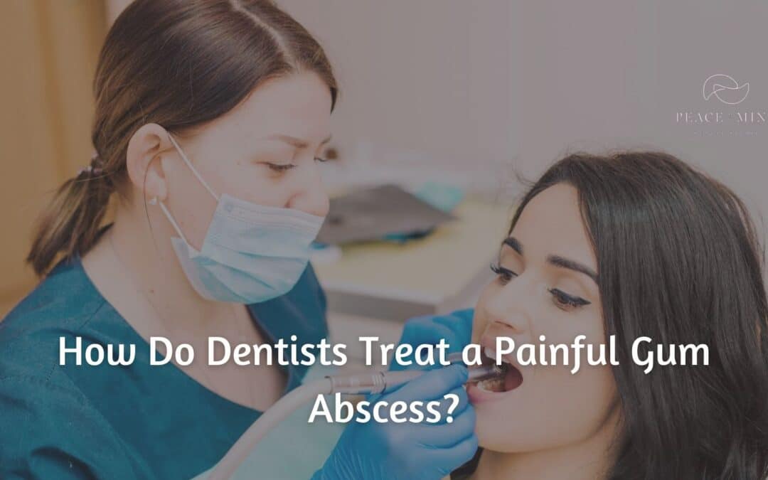 How Do Dentists Treat a Painful Gum Abscess?