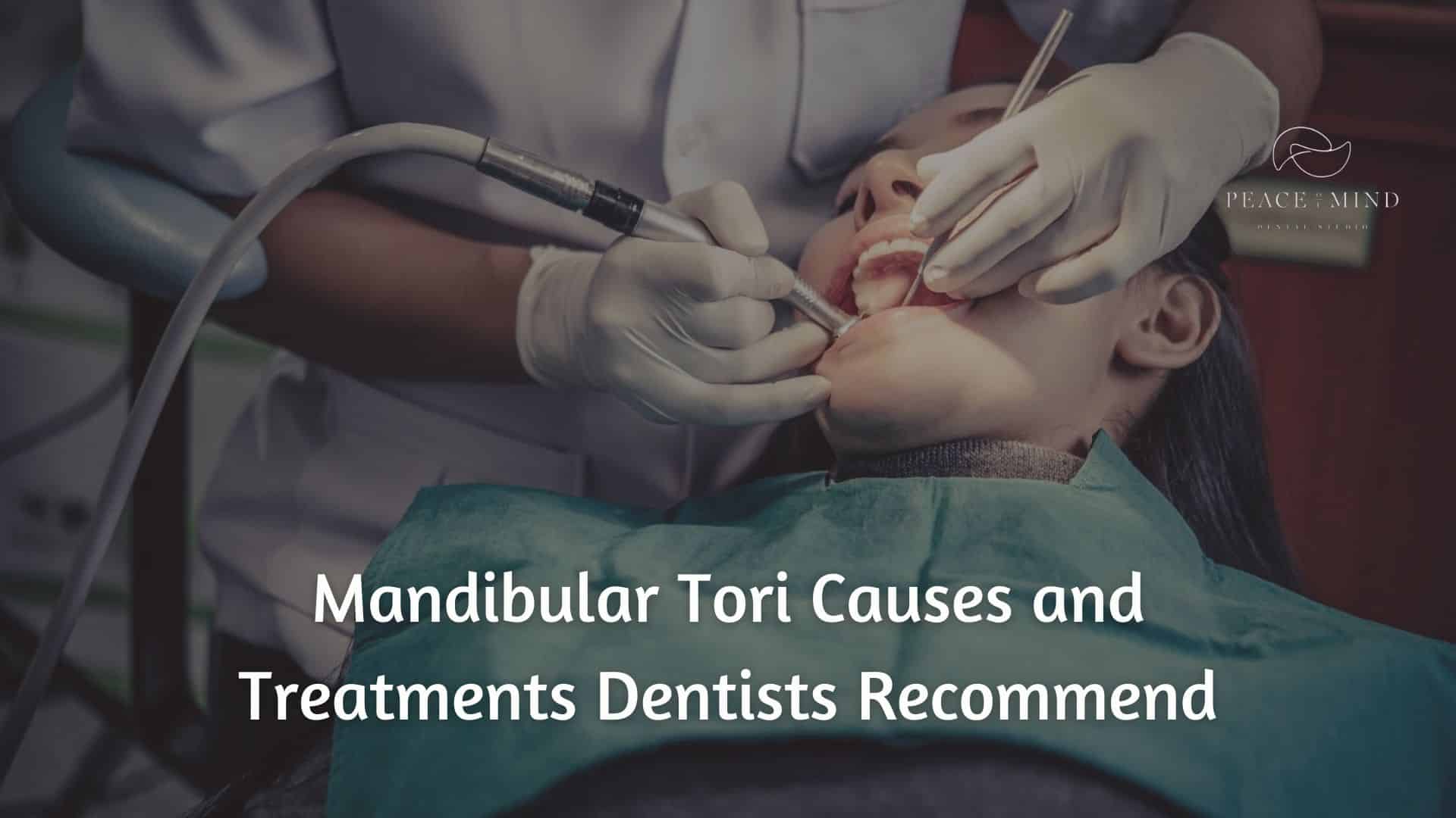 Mandibular Tori Causes and Treatments