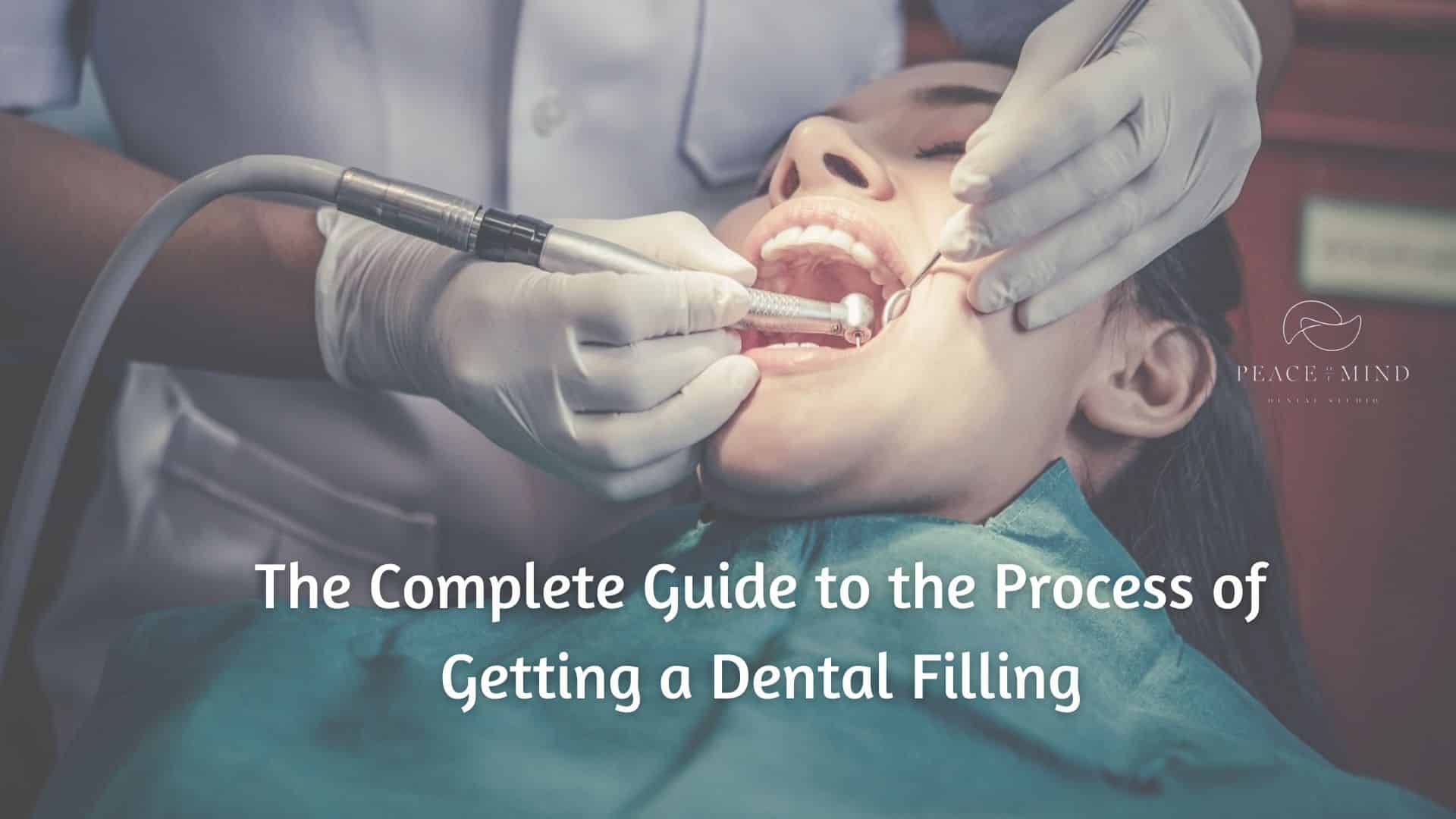 dental filling process