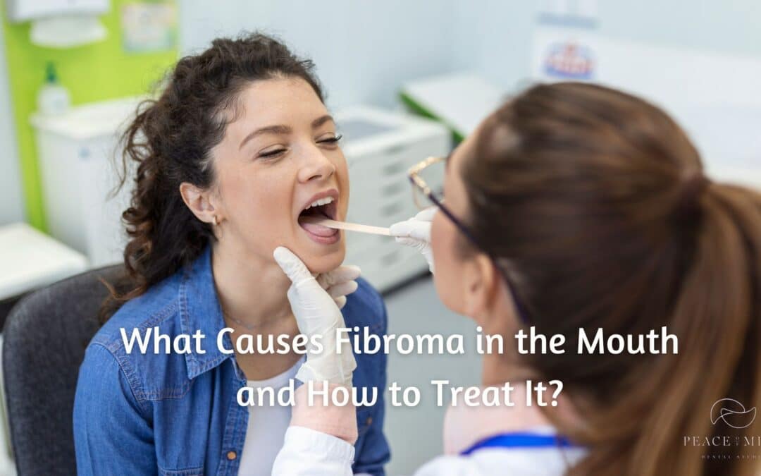 What Causes Fibroma in the Mouth and How to Treat It?