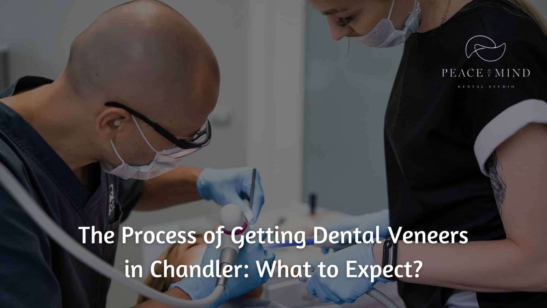Dental Veneers chandler