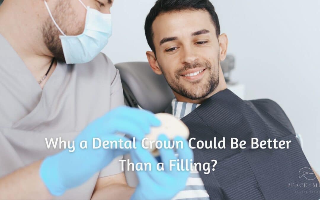 Why a Dental Crown Could Be Better Than a Filling?