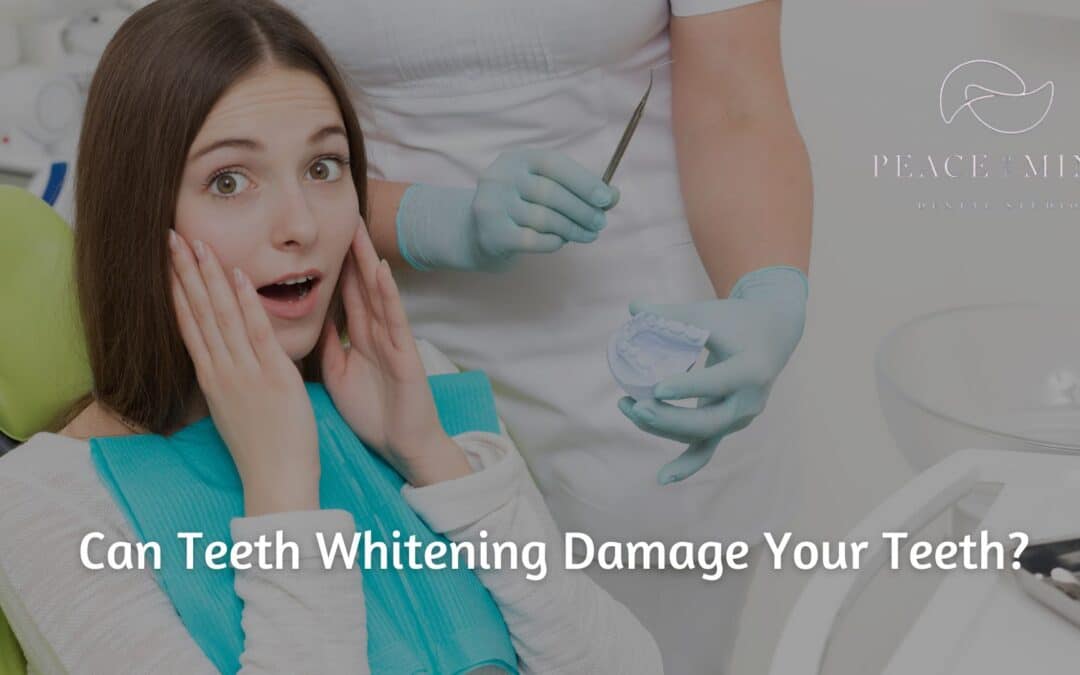 Can Teeth Whitening Damage Your Teeth?