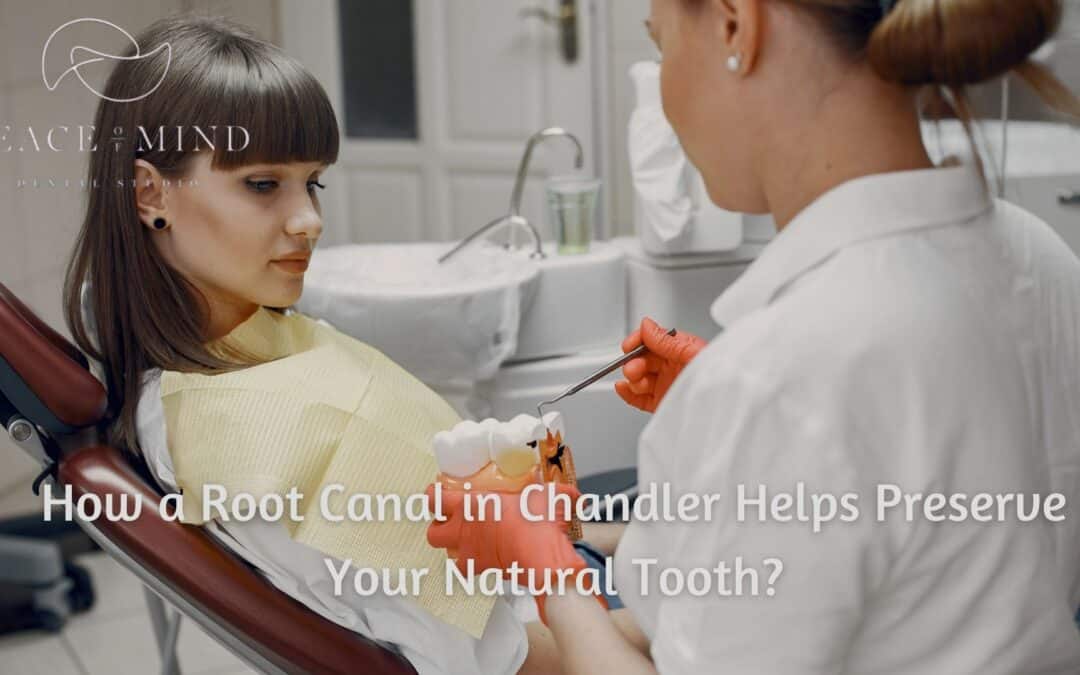 How a Root Canal in Chandler Helps Preserve Your Natural Tooth?