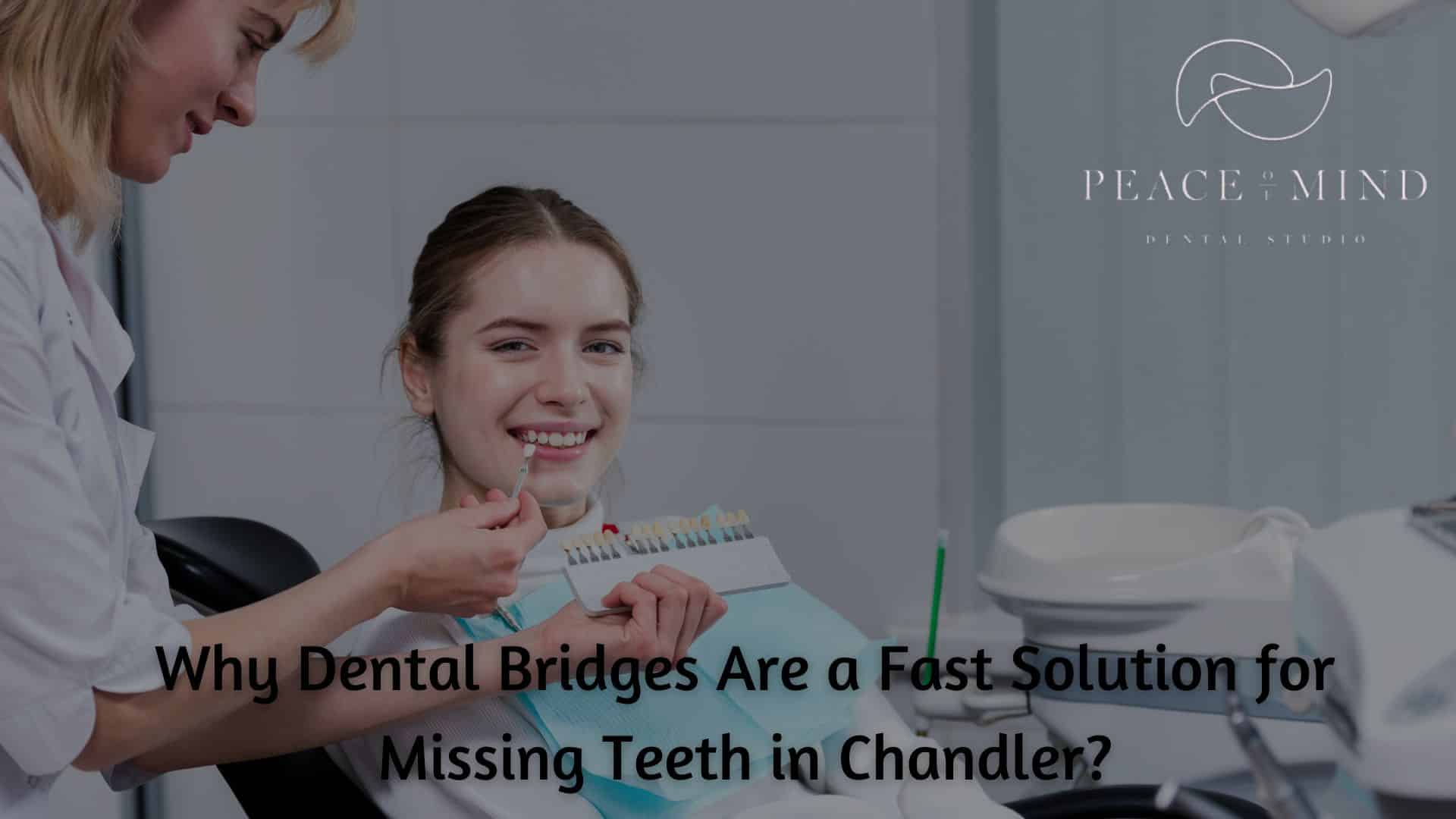 Dental bridge treatment