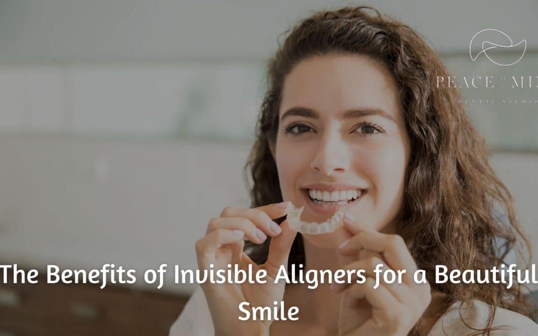 The Benefits of Invisible Aligners for a Beautiful Smile