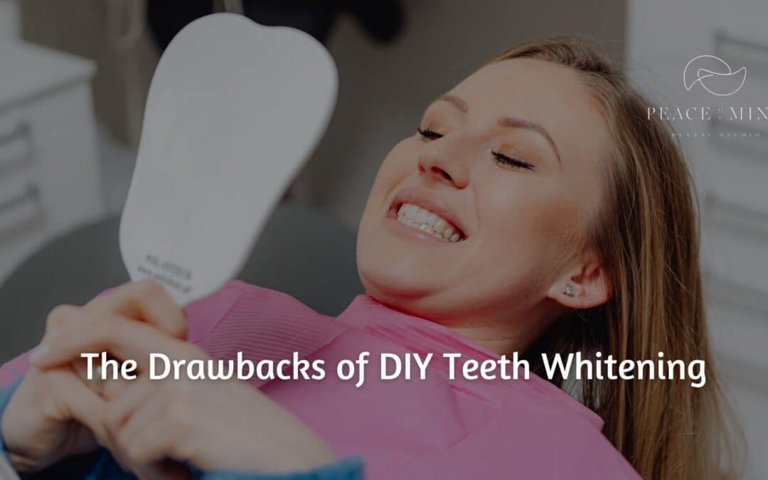 The Drawbacks of DIY Teeth Whitening